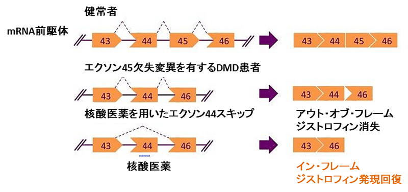 エクソンスキップ治療の概念図
